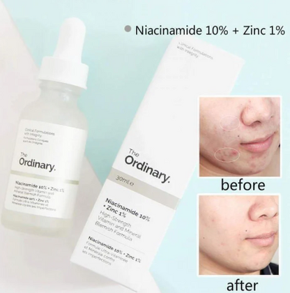 Sérum The Ordinary Niacinamida 10% + Zinc 1% 30ml